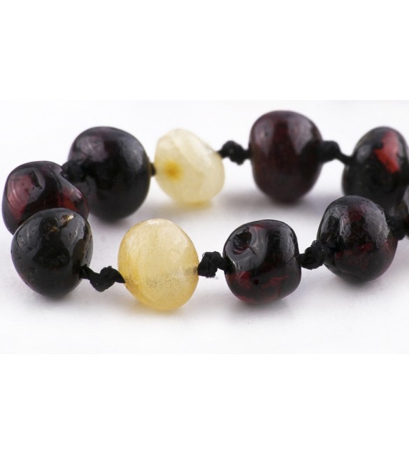 Amber Adult Bracelets Baroque Polished 3 Cherry-Lemon Amber Adult Bracelets Baroque Polished 3 Cherry-Lemon