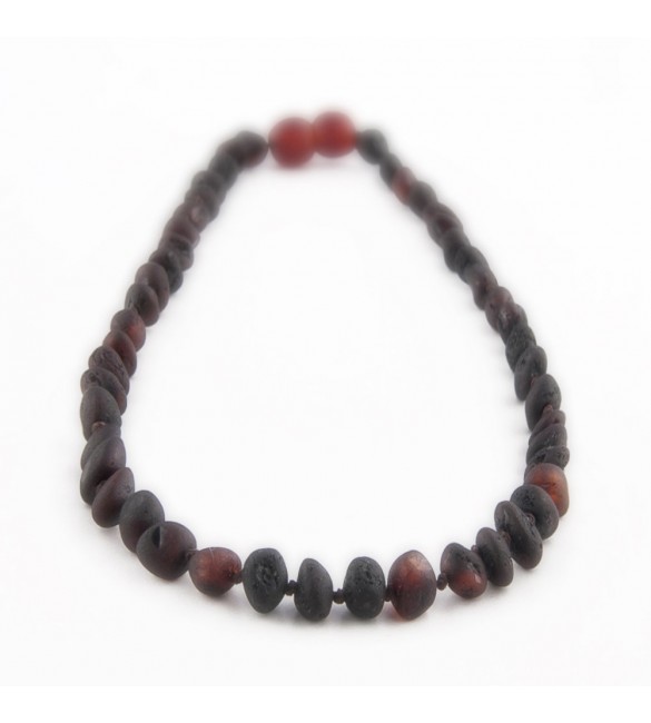 Amber Adult necklace Baroque Raw Cherry Amber Adult necklace Baroque Raw Cherry