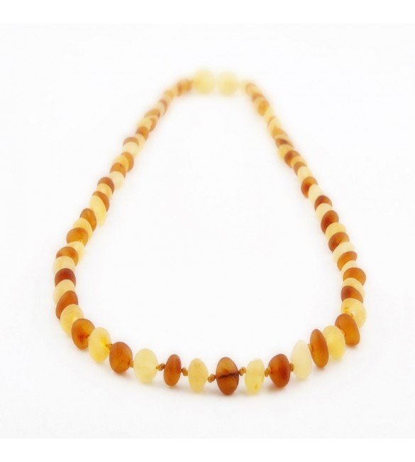 Amber Adult necklace Baroque Raw 1x1 Honey-Lemon